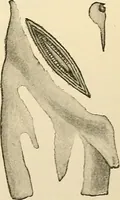 An illustration from Surgical technic; a text-book on operative surgery / by Fr. von Esmarch ... and E. Kowalzig ... translated by Professor Ludwig H. Grau ... and Willam N. Sullivan ... edited by Nicholas Senn ... With fourteen hundred and ninety-seven illustrations and fifteen colored plates. (1901)