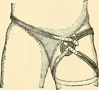 An illustration from Surgical technic; a text-book on operative surgery / by Fr. von Esmarch ... and E. Kowalzig ... translated by Professor Ludwig H. Grau ... and Willam N. Sullivan ... edited by Nicholas Senn ... With fourteen hundred and ninety-seven illustrations and fifteen colored plates. (1901)
