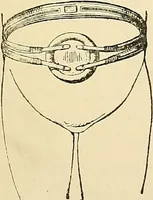 An illustration from Surgical technic; a text-book on operative surgery / by Fr. von Esmarch ... and E. Kowalzig ... translated by Professor Ludwig H. Grau ... and Willam N. Sullivan ... edited by Nicholas Senn ... With fourteen hundred and ninety-seven illustrations and fifteen colored plates. (1901)