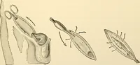 An illustration from Surgical technic; a text-book on operative surgery / by Fr. von Esmarch ... and E. Kowalzig ... translated by Professor Ludwig H. Grau ... and Willam N. Sullivan ... edited by Nicholas Senn ... With fourteen hundred and ninety-seven illustrations and fifteen colored plates. (1901)
