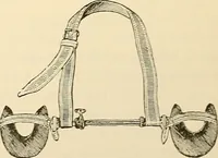 An illustration from Surgical technic; a text-book on operative surgery / by Fr. von Esmarch ... and E. Kowalzig ... translated by Professor Ludwig H. Grau ... and Willam N. Sullivan ... edited by Nicholas Senn ... With fourteen hundred and ninety-seven illustrations and fifteen colored plates. (1901)