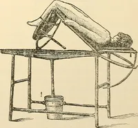 An illustration from Surgical technic; a text-book on operative surgery / by Fr. von Esmarch ... and E. Kowalzig ... translated by Professor Ludwig H. Grau ... and Willam N. Sullivan ... edited by Nicholas Senn ... With fourteen hundred and ninety-seven illustrations and fifteen colored plates. (1901)