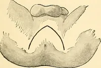 An illustration from Surgical technic; a text-book on operative surgery / by Fr. von Esmarch ... and E. Kowalzig ... translated by Professor Ludwig H. Grau ... and Willam N. Sullivan ... edited by Nicholas Senn ... With fourteen hundred and ninety-seven illustrations and fifteen colored plates. (1901)