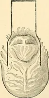 An illustration from Surgical technic; a text-book on operative surgery / by Fr. von Esmarch ... and E. Kowalzig ... translated by Professor Ludwig H. Grau ... and Willam N. Sullivan ... edited by Nicholas Senn ... With fourteen hundred and ninety-seven illustrations and fifteen colored plates. (1901)