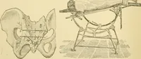 An illustration from Surgical technic; a text-book on operative surgery / by Fr. von Esmarch ... and E. Kowalzig ... translated by Professor Ludwig H. Grau ... and Willam N. Sullivan ... edited by Nicholas Senn ... With fourteen hundred and ninety-seven illustrations and fifteen colored plates. (1901)