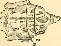 An illustration from Surgical technic; a text-book on operative surgery / by Fr. von Esmarch ... and E. Kowalzig ... translated by Professor Ludwig H. Grau ... and Willam N. Sullivan ... edited by Nicholas Senn ... With fourteen hundred and ninety-seven illustrations and fifteen colored plates. (1901)