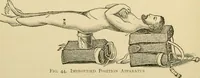 An illustration from Surgical technic; a text-book on operative surgery / by Fr. von Esmarch ... and E. Kowalzig ... translated by Professor Ludwig H. Grau ... and Willam N. Sullivan ... edited by Nicholas Senn ... With fourteen hundred and ninety-seven illustrations and fifteen colored plates. (1901)
