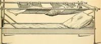 An illustration from Surgical technic; a text-book on operative surgery / by Fr. von Esmarch ... and E. Kowalzig ... translated by Professor Ludwig H. Grau ... and Willam N. Sullivan ... edited by Nicholas Senn ... With fourteen hundred and ninety-seven illustrations and fifteen colored plates. (1901)