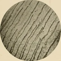 An illustration from The practice of dental medicine / By George F. Eames. Containing thirty-eight engravings and three colored plates. (1899)