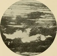 An illustration from The practice of dental medicine / By George F. Eames. Containing thirty-eight engravings and three colored plates. (1899)
