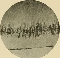 An illustration from The practice of dental medicine / By George F. Eames. Containing thirty-eight engravings and three colored plates. (1899)