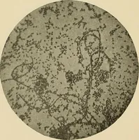 An illustration from The practice of dental medicine / By George F. Eames. Containing thirty-eight engravings and three colored plates. (1899)