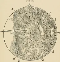 An illustration from The practice of dental medicine / By George F. Eames. Containing thirty-eight engravings and three colored plates. (1899)