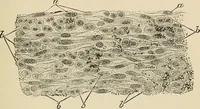 An illustration from The practice of dental medicine / By George F. Eames. Containing thirty-eight engravings and three colored plates. (1899)