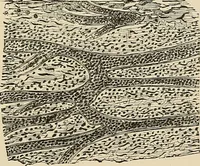 An illustration from The practice of dental medicine / By George F. Eames. Containing thirty-eight engravings and three colored plates. (1899)