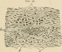 An illustration from The practice of dental medicine / By George F. Eames. Containing thirty-eight engravings and three colored plates. (1899)