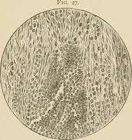 An illustration from The practice of dental medicine / By George F. Eames. Containing thirty-eight engravings and three colored plates. (1899)
