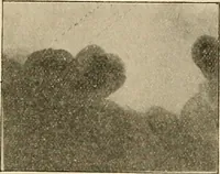 An illustration from The practice of dental medicine / By George F. Eames. Containing thirty-eight engravings and three colored plates. (1899)