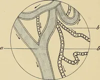 An illustration from The practice of dental medicine / By George F. Eames. Containing thirty-eight engravings and three colored plates. (1899)