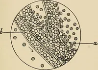 An illustration from The practice of dental medicine / By George F. Eames. Containing thirty-eight engravings and three colored plates. (1899)