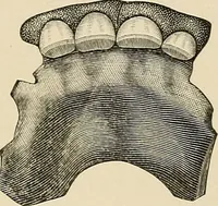 An illustration from The practice of dental medicine / By George F. Eames. Containing thirty-eight engravings and three colored plates. (1899)