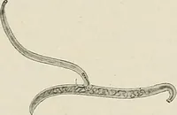 An illustration from Hookworm disease : etiology, pathology, diagnosis, prognosis, prophylaxis, and treatment / by George Dock and Charles C. Bass. Illustrated with forty-nine special engravings and colored plate. (1910)
