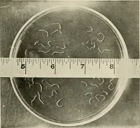 An illustration from Hookworm disease : etiology, pathology, diagnosis, prognosis, prophylaxis, and treatment / by George Dock and Charles C. Bass. Illustrated with forty-nine special engravings and colored plate. (1910)