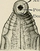 An illustration from Hookworm disease : etiology, pathology, diagnosis, prognosis, prophylaxis, and treatment / by George Dock and Charles C. Bass. Illustrated with forty-nine special engravings and colored plate. (1910)