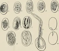 An illustration from Hookworm disease : etiology, pathology, diagnosis, prognosis, prophylaxis, and treatment / by George Dock and Charles C. Bass. Illustrated with forty-nine special engravings and colored plate. (1910)