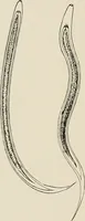 An illustration from Hookworm disease : etiology, pathology, diagnosis, prognosis, prophylaxis, and treatment / by George Dock and Charles C. Bass. Illustrated with forty-nine special engravings and colored plate. (1910)