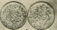 An illustration from Hookworm disease : etiology, pathology, diagnosis, prognosis, prophylaxis, and treatment / by George Dock and Charles C. Bass. Illustrated with forty-nine special engravings and colored plate. (1910)