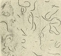 An illustration from Hookworm disease : etiology, pathology, diagnosis, prognosis, prophylaxis, and treatment / by George Dock and Charles C. Bass. Illustrated with forty-nine special engravings and colored plate. (1910)