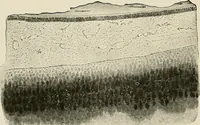 An illustration from Hookworm disease : etiology, pathology, diagnosis, prognosis, prophylaxis, and treatment / by George Dock and Charles C. Bass. Illustrated with forty-nine special engravings and colored plate. (1910)