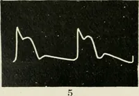 Picture 2 of 135 from A manual of modern surgery, general and operative : With 188 illus. in the text and 13 full-page plates in colors and tints, aggregating 276 separate figures. (1894), leaf 10