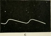 Picture 3 of 135 from A manual of modern surgery, general and operative : With 188 illus. in the text and 13 full-page plates in colors and tints, aggregating 276 separate figures. (1894), leaf 10