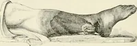 An illustration from A manual of modern surgery, general and operative : With 188 illus. in the text and 13 full-page plates in colors and tints, aggregating 276 separate figures. (1894)