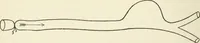 An illustration from A manual of modern surgery, general and operative : With 188 illus. in the text and 13 full-page plates in colors and tints, aggregating 276 separate figures. (1894)