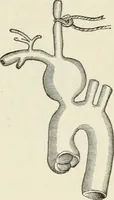 Picture 30 of 135 from A manual of modern surgery, general and operative : With 188 illus. in the text and 13 full-page plates in colors and tints, aggregating 276 separate figures. (1894), leaf 253