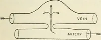 Picture 31 of 135 from A manual of modern surgery, general and operative : With 188 illus. in the text and 13 full-page plates in colors and tints, aggregating 276 separate figures. (1894), leaf 255