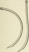 An illustration from A manual of modern surgery, general and operative : With 188 illus. in the text and 13 full-page plates in colors and tints, aggregating 276 separate figures. (1894)