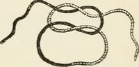 An illustration from A manual of modern surgery, general and operative : With 188 illus. in the text and 13 full-page plates in colors and tints, aggregating 276 separate figures. (1894)