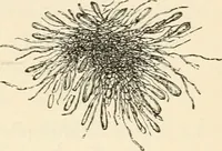 An illustration from A manual of modern surgery, general and operative : With 188 illus. in the text and 13 full-page plates in colors and tints, aggregating 276 separate figures. (1894)