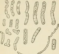 An illustration from A manual of modern surgery, general and operative : With 188 illus. in the text and 13 full-page plates in colors and tints, aggregating 276 separate figures. (1894)