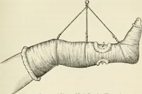 Picture 41 of 135 from A manual of modern surgery, general and operative : With 188 illus. in the text and 13 full-page plates in colors and tints, aggregating 276 separate figures. (1894), leaf 349