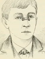 An illustration from A manual of modern surgery, general and operative : With 188 illus. in the text and 13 full-page plates in colors and tints, aggregating 276 separate figures. (1894)