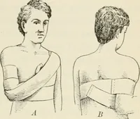 An illustration from A manual of modern surgery, general and operative : With 188 illus. in the text and 13 full-page plates in colors and tints, aggregating 276 separate figures. (1894)