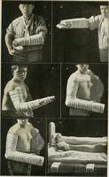 Picture 45 of 135 from A manual of modern surgery, general and operative : With 188 illus. in the text and 13 full-page plates in colors and tints, aggregating 276 separate figures. (1894), leaf 381