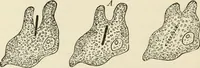 An illustration from A manual of modern surgery, general and operative : With 188 illus. in the text and 13 full-page plates in colors and tints, aggregating 276 separate figures. (1894)
