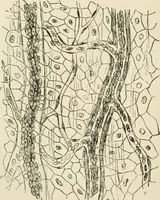 An illustration from A manual of modern surgery, general and operative : With 188 illus. in the text and 13 full-page plates in colors and tints, aggregating 276 separate figures. (1894)
