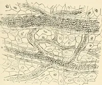 An illustration from A manual of modern surgery, general and operative : With 188 illus. in the text and 13 full-page plates in colors and tints, aggregating 276 separate figures. (1894)